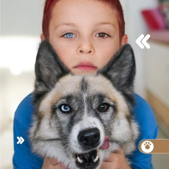 heterocromia-nino-perro.jpg